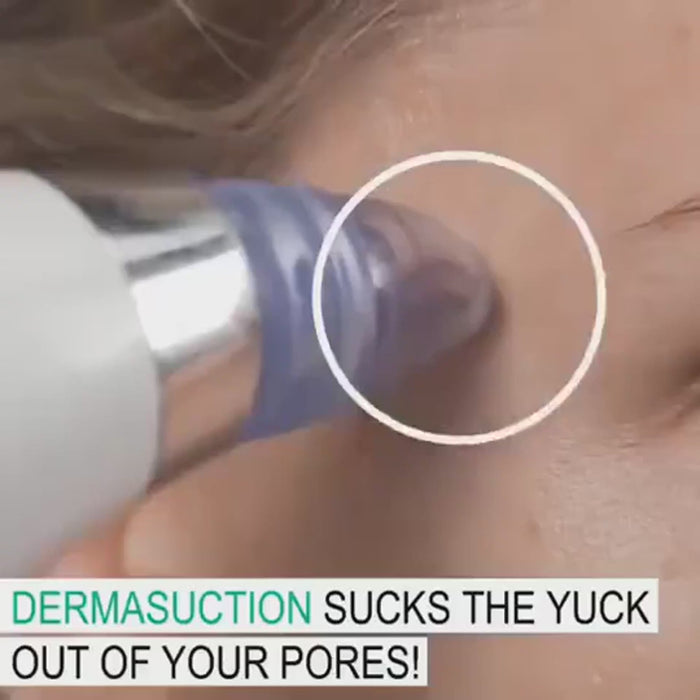 Blackhead Remover | أداة إزالة الرؤوس السوداء