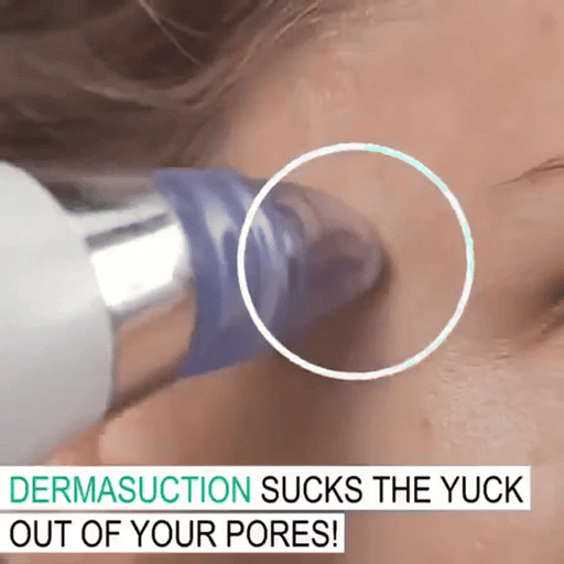 Blackhead Remover | أداة إزالة الرؤوس السوداء