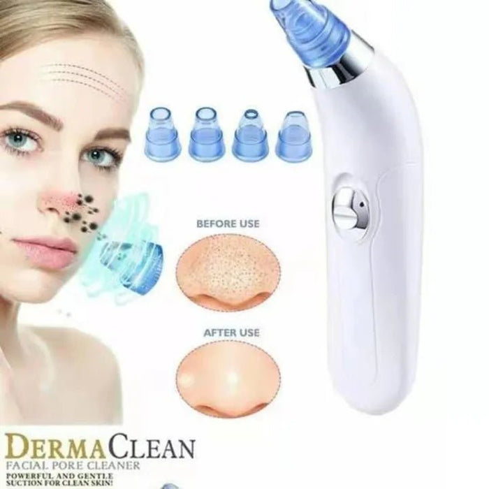 Blackhead Remover | أداة إزالة الرؤوس السوداء