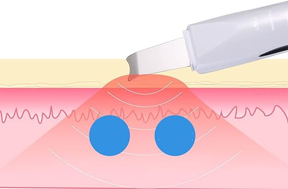 Face Blackhead Remover – Deep Cleansing & Skin Rejuvenation Device | جهاز إزالة الرؤوس السوداء وتنظيف عميق وتجديد البشرة | KSA Delivery 1-3 Days